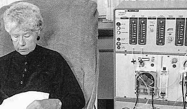 The history of dialysis